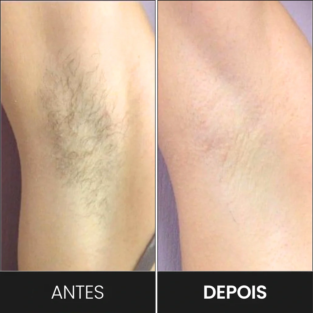 Imagem do produto 6