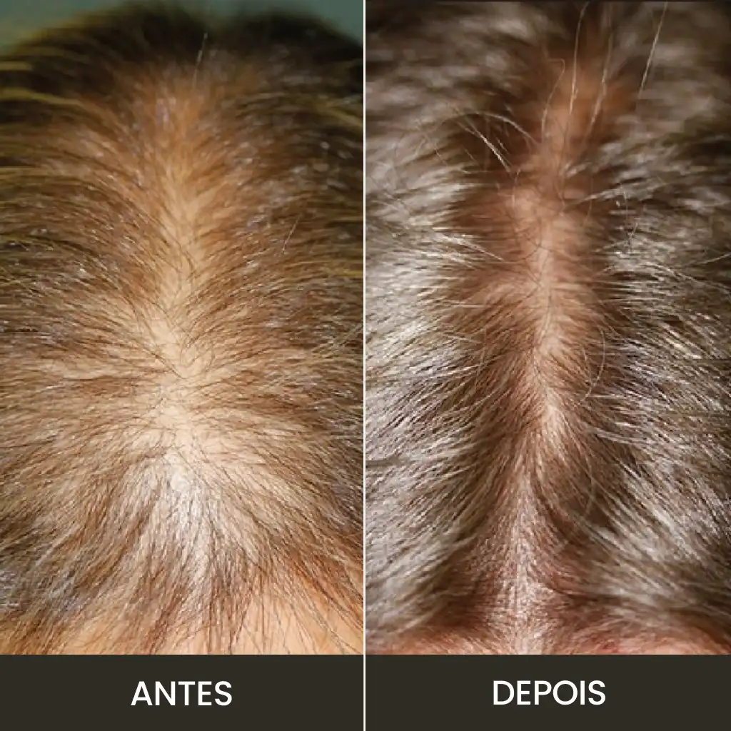 Imagem do produto 8