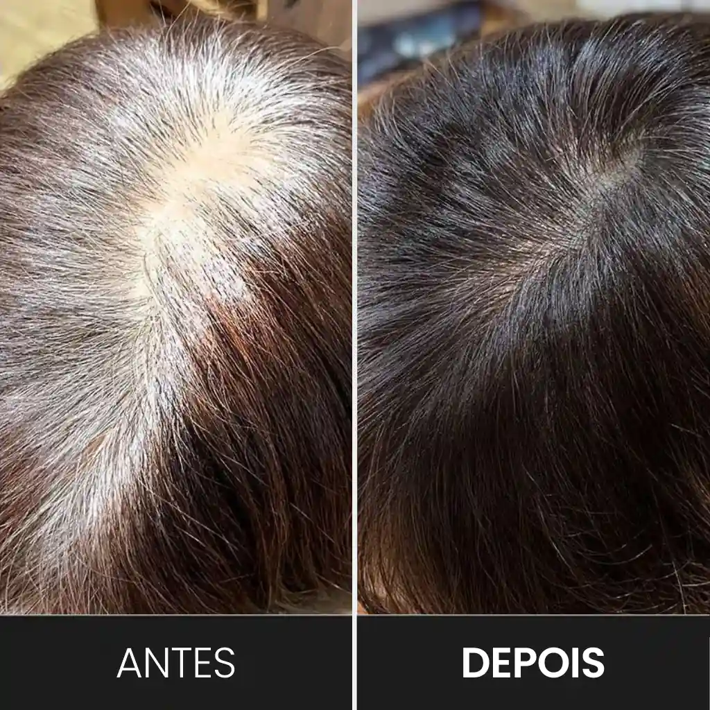 Imagem do produto 4
