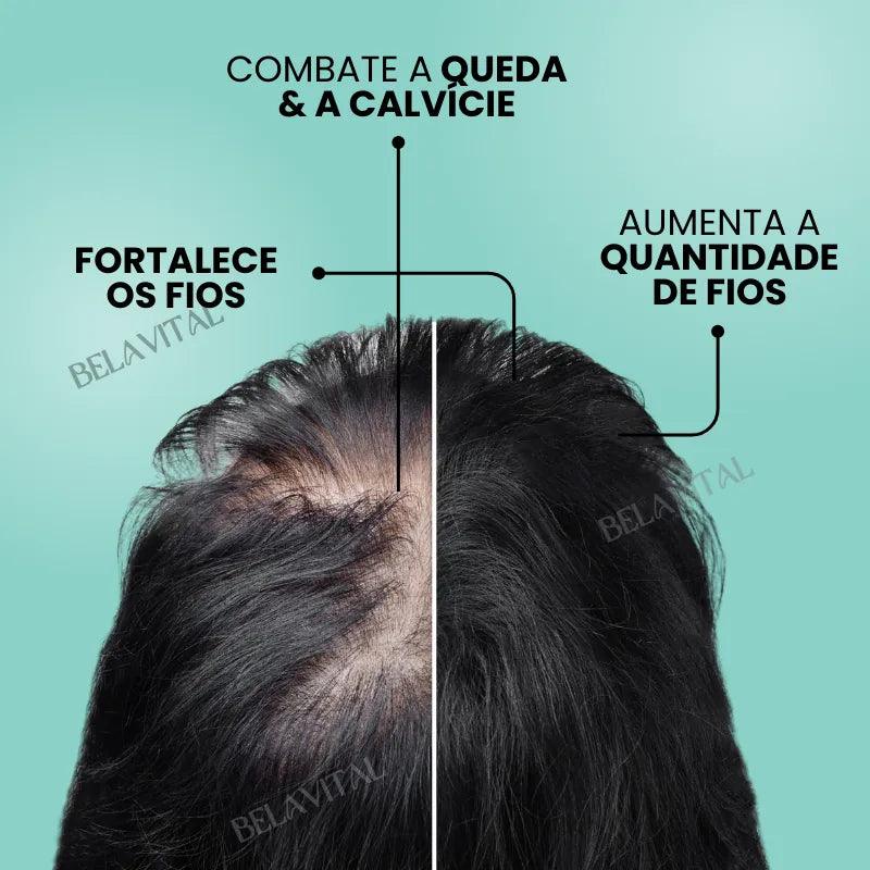 Imagem do produto 3